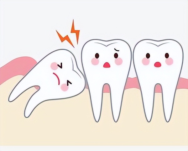 智慧牙是哪一颗（长智齿的初始反应）