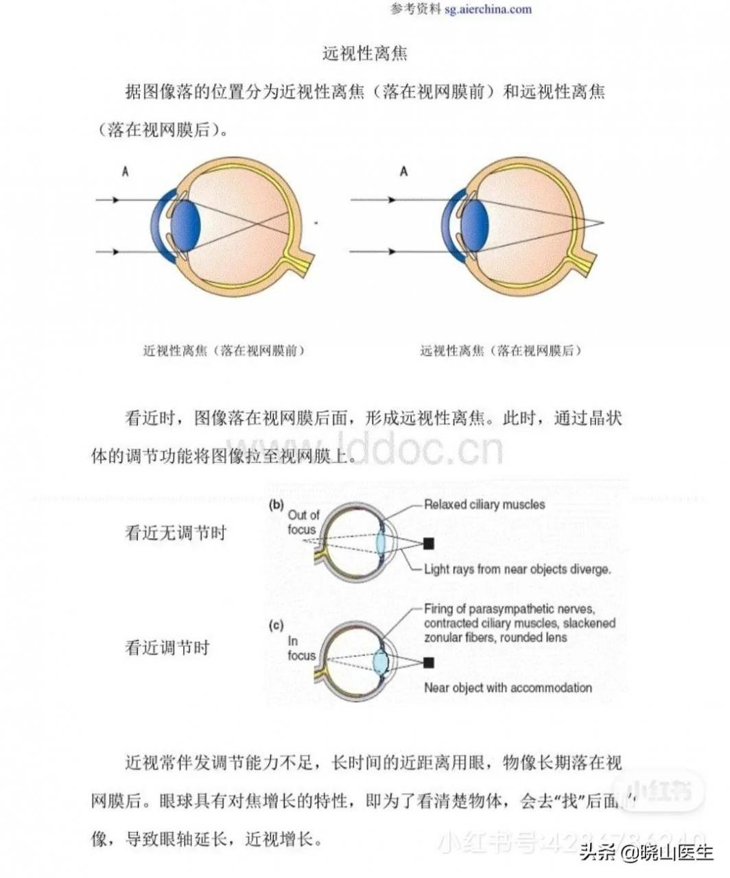 大夫不建议使用星趣控镜片