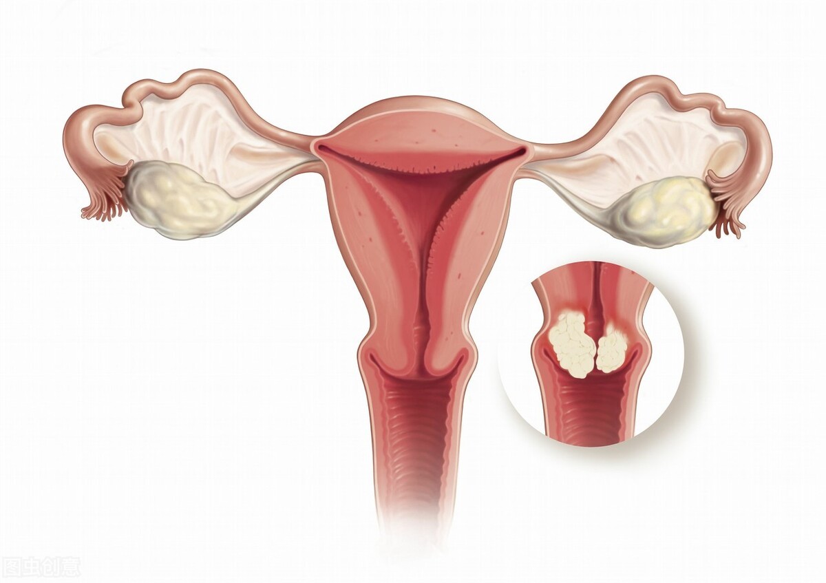 已满26未满27能打九价hpv（九价三针都必须在26岁之内吗）