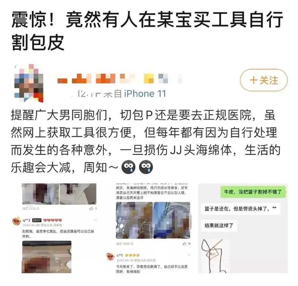 割包为什么很多人后悔 (成年割包好处和坏处)