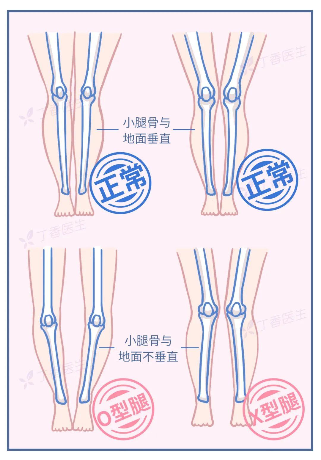 为什么女的腿都不直(为什么要看女的腿)