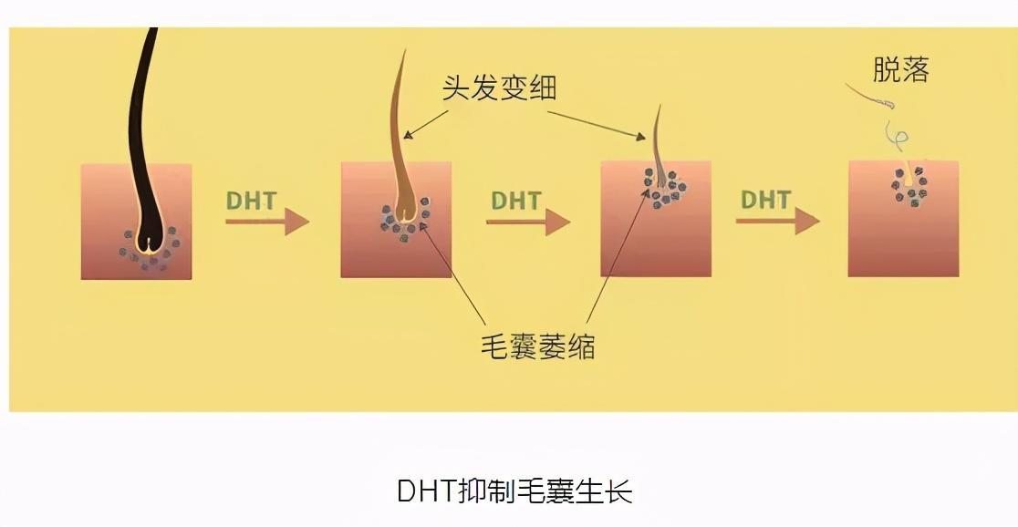 为什么秃头从前面开始(为什么开始秃头了)